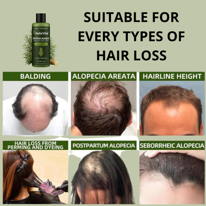Keratin + Rosemary + Nettle + Biotin - Nourishing and Regenerating Shampoo for Thick, Voluminous Hair