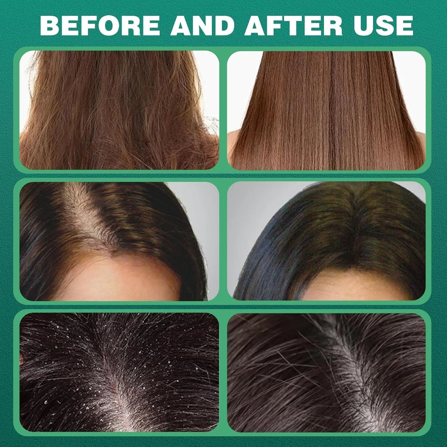 Helix Vital™ Cypress Leaf HairGrowth Soap