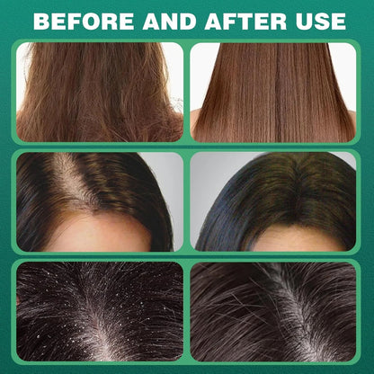 Helix Vital™ Cypress Leaf HairGrowth Soap