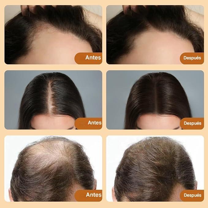 Aceite de Romero y Menta: El Secreto Natural para un Cabello Fuerte y Abundante